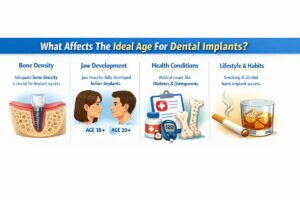 What Affects The Ideal Age For Dental Implants