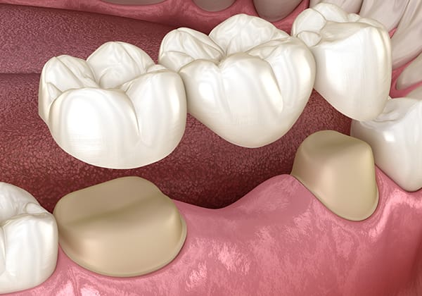 General Dentistry in Medicine Hat